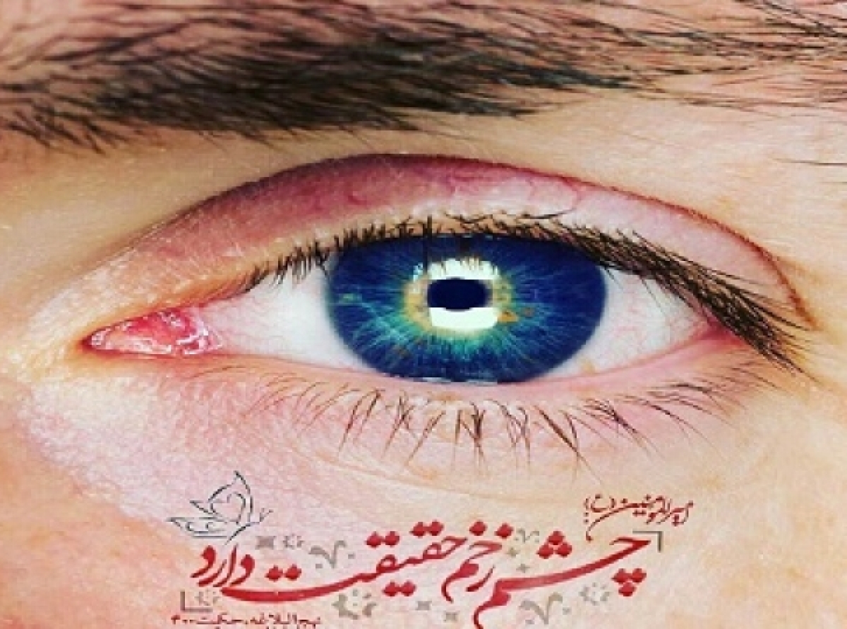 چشم زخم و راهکارهاش